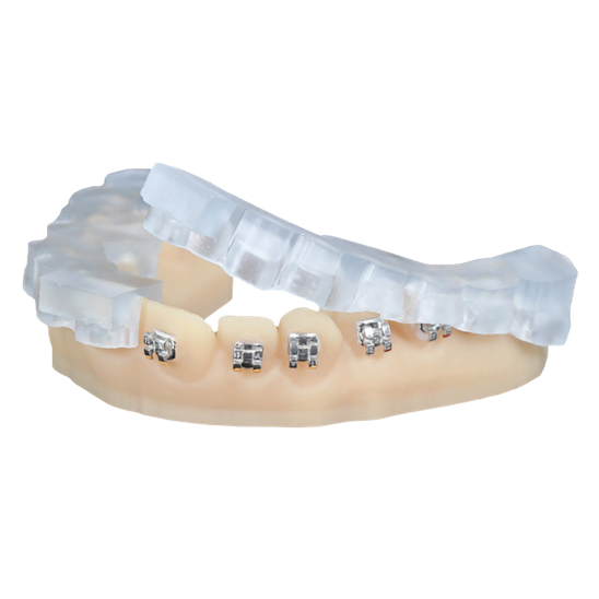 KeyOrtho IBT™ by Keystone Industries