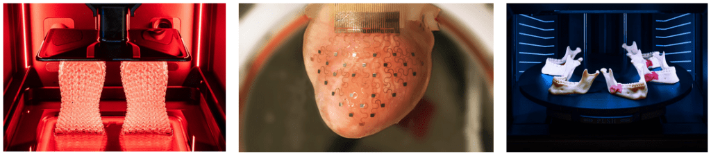 3D Printing in Medicine