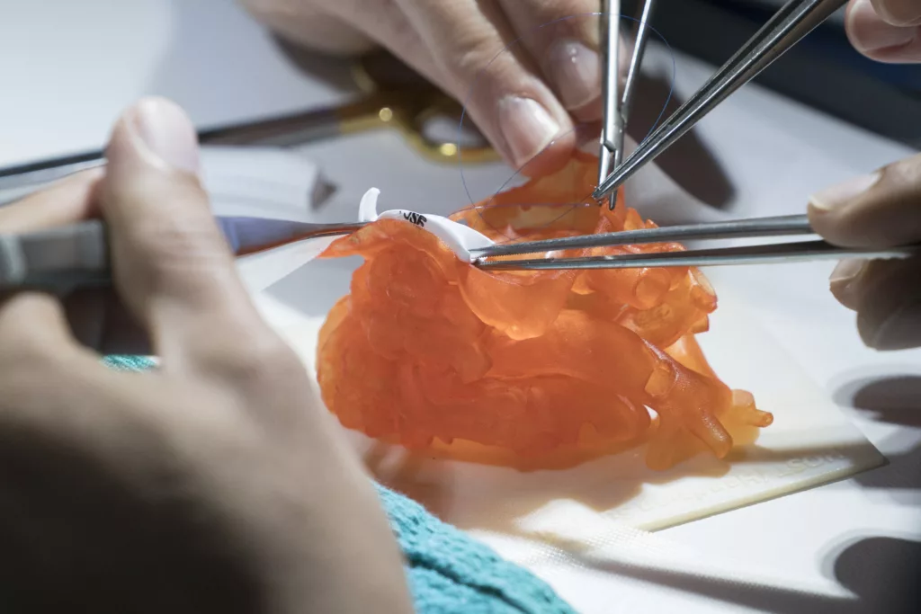 How 3D Printing is Impacting Healthcare